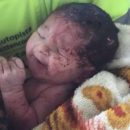 brasile-neonata-nasce-durante-un-incidente-stradale