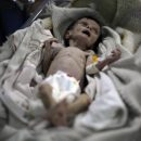Sahar bimba morta fame Siria