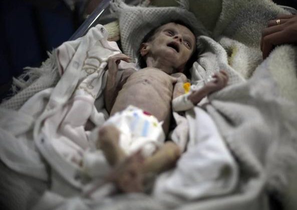 Sahar bimba morta fame Siria