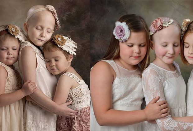 bambini-sconfiggono-il-cancro-quelle-foto-che-sono-un-inno-alla-vita