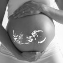 analisi-dna-prenatale-una-possibilita-piu-per-la-diagnosi