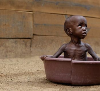 kenya bambini malnutriti siccità