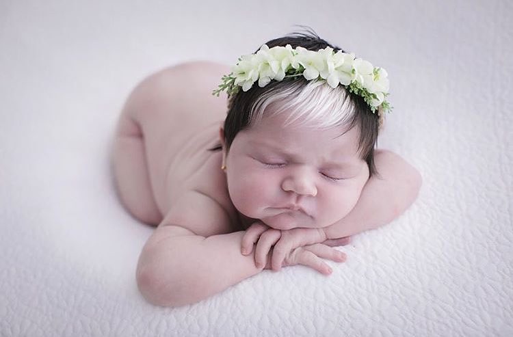 Bambina Bianca Nata Da Genitori Neri