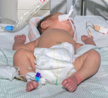 veneto-7-neonati-ricoverati-per-la-pertosse-problema-immunizzazione-per-le-mamme